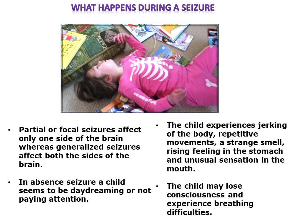 Symptoms of Seizures in Children